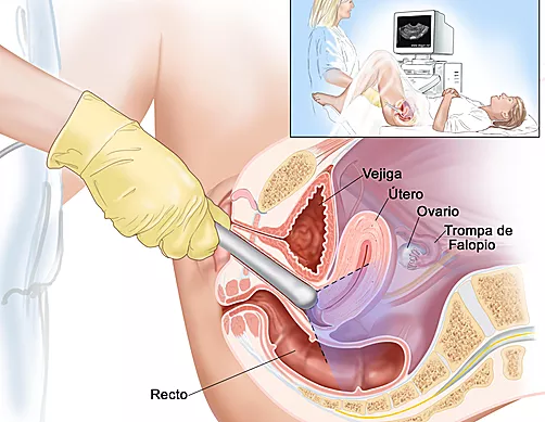 Papanicolaou La CitologÃa Detecta Embarazo Estoy Embarazada El